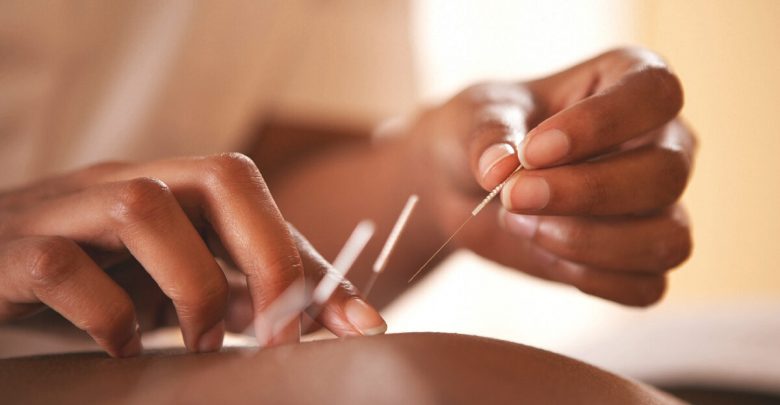 Access to Quality Needles for Acupuncture in Australia