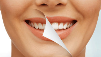 Complications of Teeth Bleaching