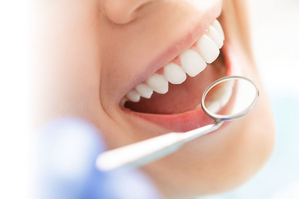 dental implants in North Vancouver