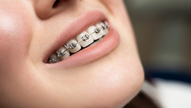 All Possible Complications Associated with Orthodontic Treatment